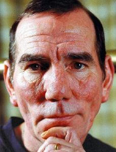 Pete Postlethwaite